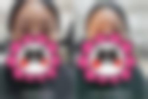 浙江大学医学校附属第二医院眼科中 心预约挂号方式。