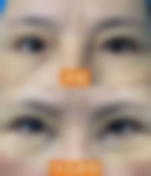 Q:医院支持医疗保险报销吗?