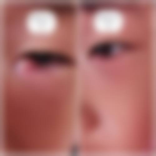 Q:优惠活动有效期多久?需要到院后立即缴费吗?