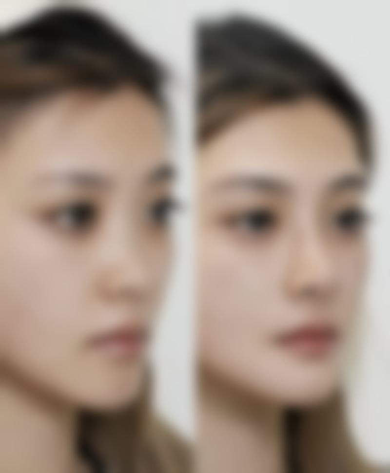 宁波海曙美苑整形医院预约挂号方式。