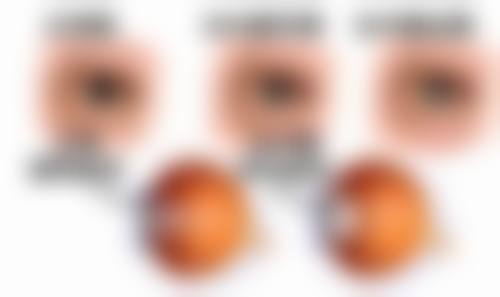 兴义市人民医院眼科的常规手术项目