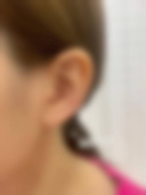 惠州瑞禧医疗美容诊所2026年价格收费表: