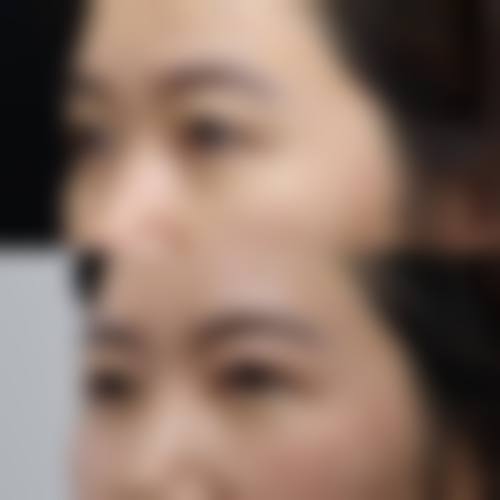 巴彦淖尔优嘉整形医院治疗反馈与口碑评价。