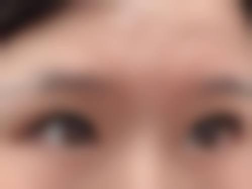 巴彦淖尔优嘉整形医院擅长项目。