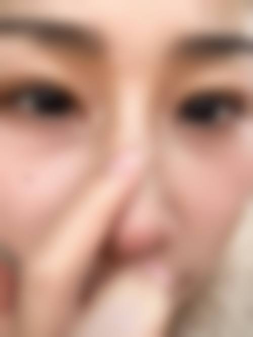 威海芊禾整形医院治疗反馈与口碑评价。