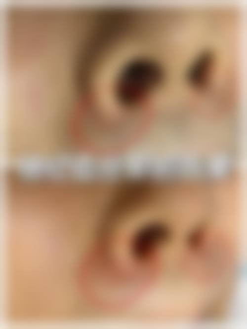 河源李陵峰美容诊所医生团队经验稳定。