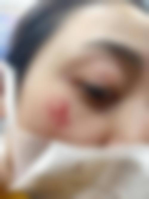河源李陵峰美容诊所2026年价格收费表: