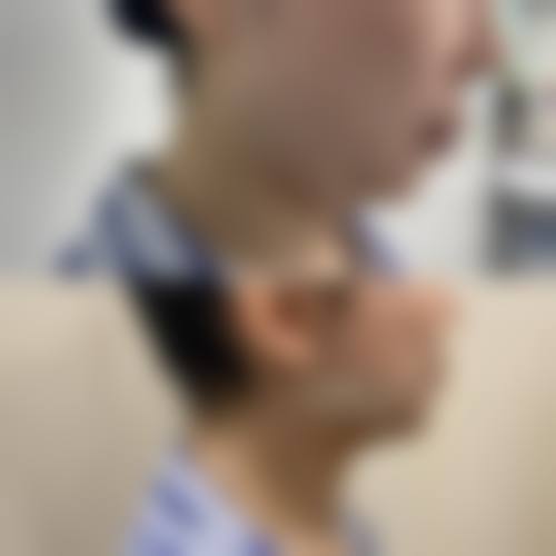 威海芊禾整形医院擅长项目。