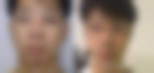 新疆自治区中医院地理位置便于到院。
