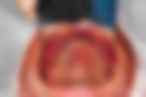 优惠活动详情：限时特别优惠，预约即享