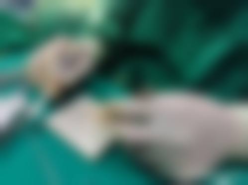 擅长项目详解 —— 眼部整形与面部轮廓的精细艺术
