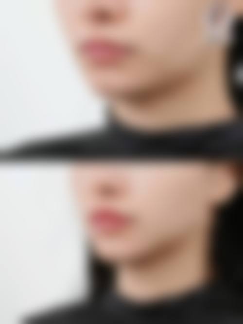 患者真实评价 —— 来自求美者的真实反馈
