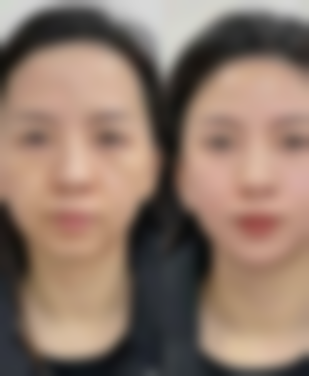宁德新颜至美整形医院预约挂号方式。