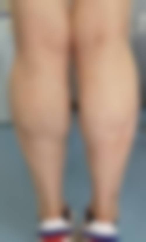 青岛新采韵医疗美容诊所擅长项目。