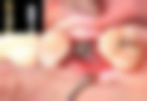 厦门市中医院口腔科预约挂号方式。