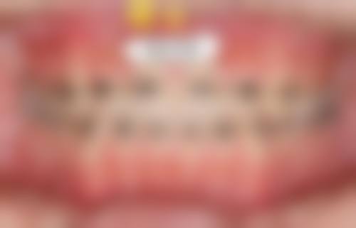 淄博张店殷广礼口腔预约挂号方式。