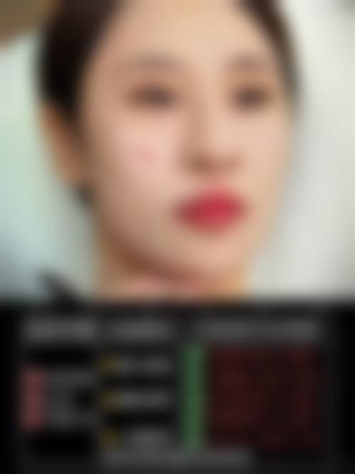 福州高新区华窈医疗美容诊所预约挂号方式。