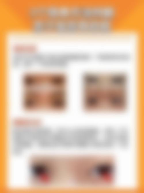 阿克苏美尼康眼科医院治疗反馈与口碑评价。