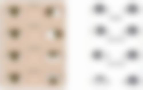 阿克苏美尼康眼科医院擅长项目。