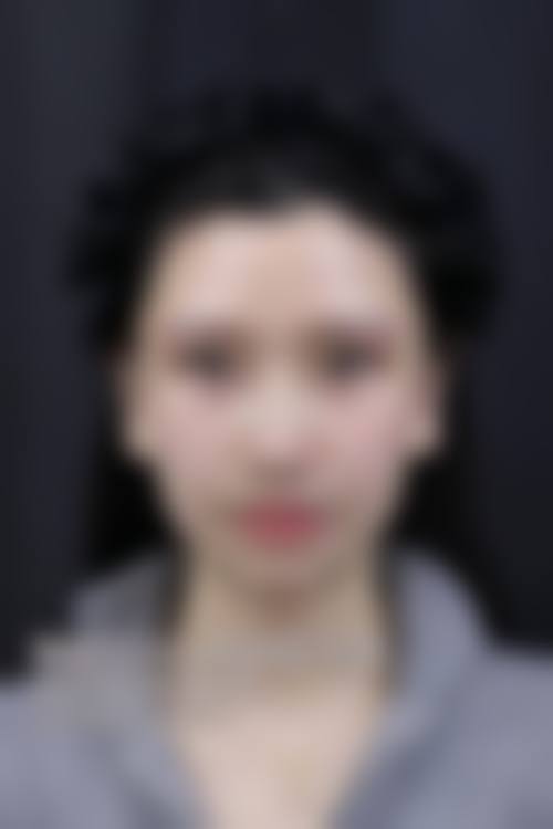 包头时光整形美容医院2026年价格收费表: