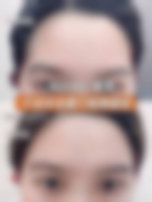 包头时光整形美容医院治疗反馈与口碑评价。