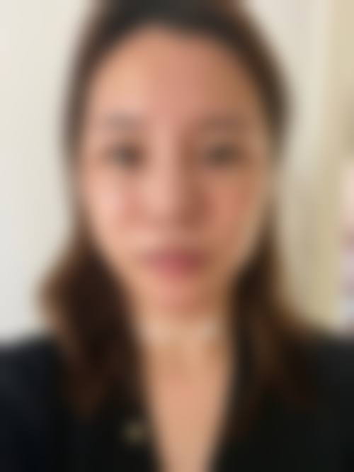韩国shes good私密整形治疗反馈与口碑评价。
