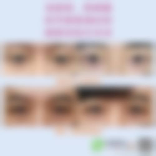 优惠活动与患者保护