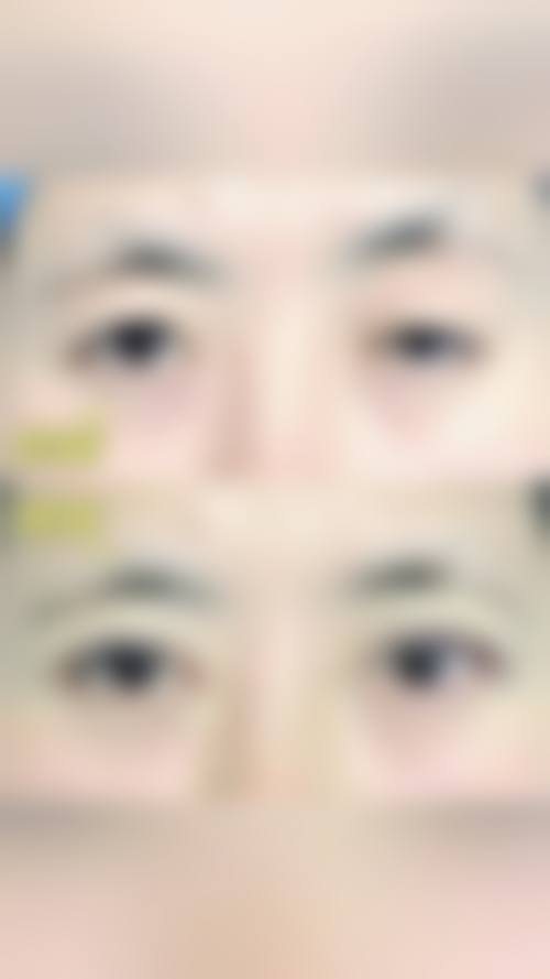 皖南医学校第一附属医院眼科预约挂号方式。