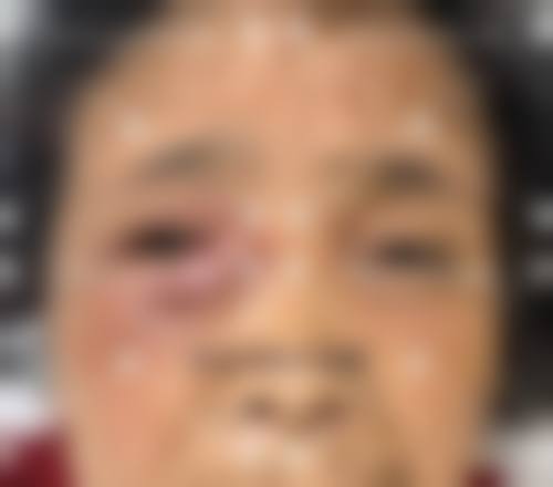 吉林新华明眼科医院擅长项目。