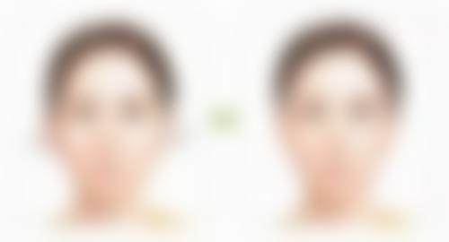 郑州明星医疗美容诊所擅长的项目
