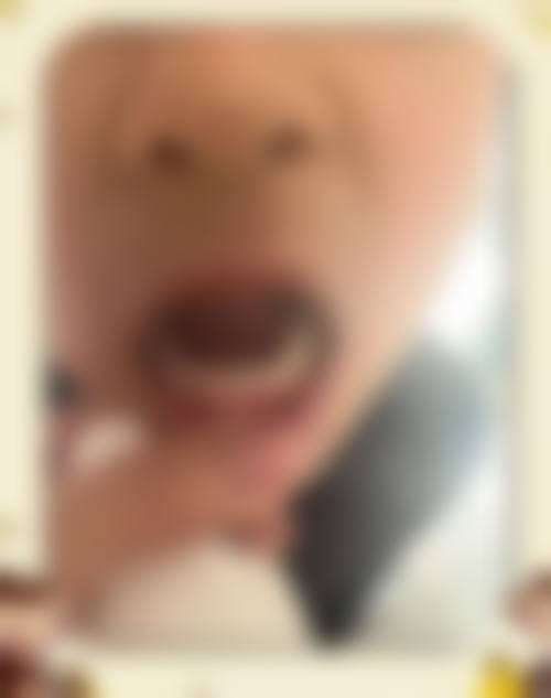 杨富强医生擅长的治疗项目