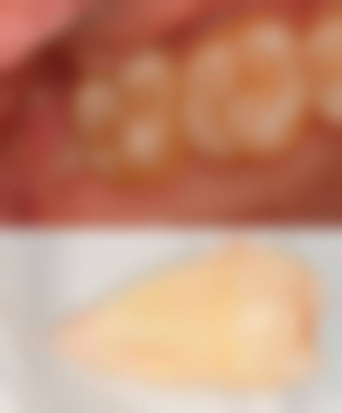 济南历下口腔治疗反馈与口碑评价。
