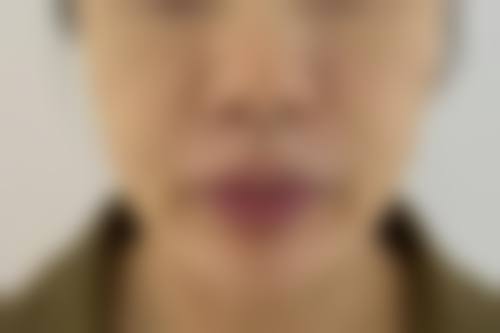 蒲韵医生的技术实力