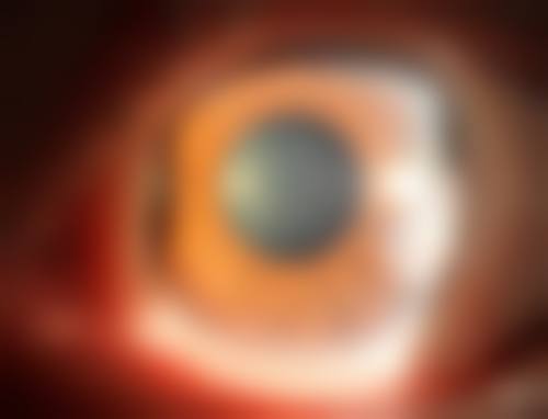 福州市第二医院眼科口碑评价
