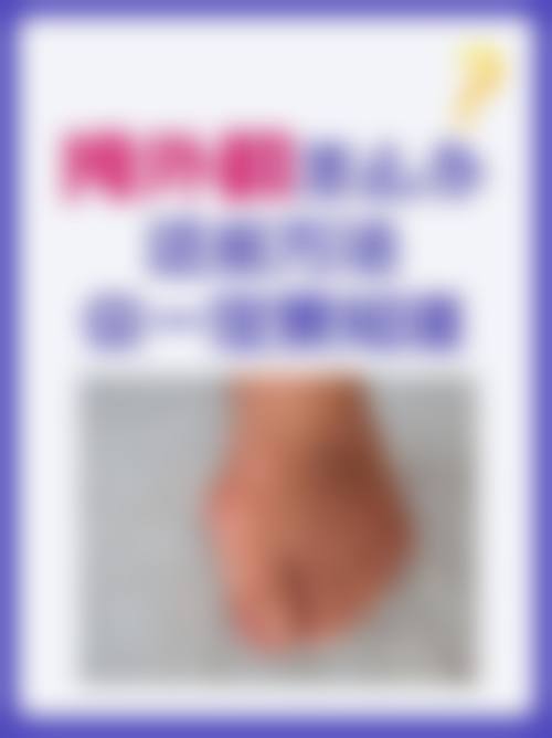 预约优惠活动