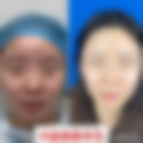 蕲春县汪美华整形医院擅长项目。