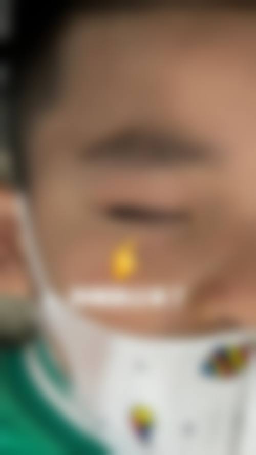 漳州市中医院眼科医生团队经验稳定。