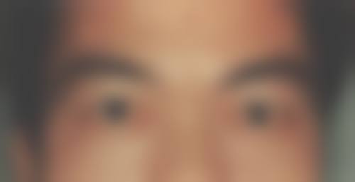 临沂费县光明眼科医院设备精良。