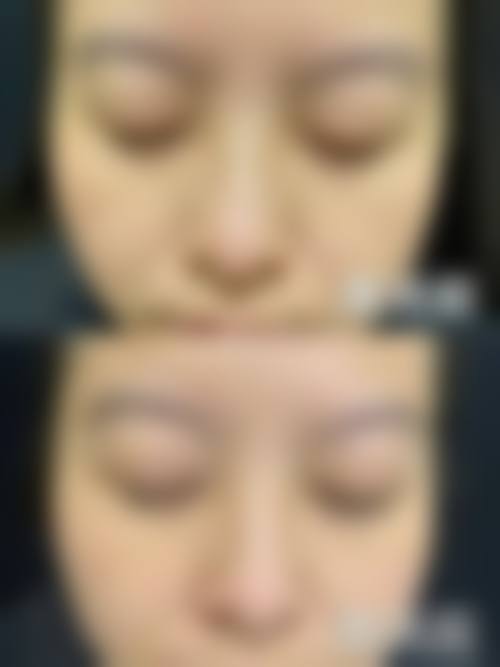 擅长项目详解