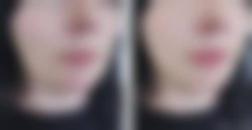 患者真实评价