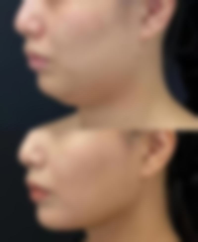 临床实例分享
