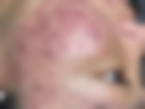 济南艾媚整形医院擅长项目。