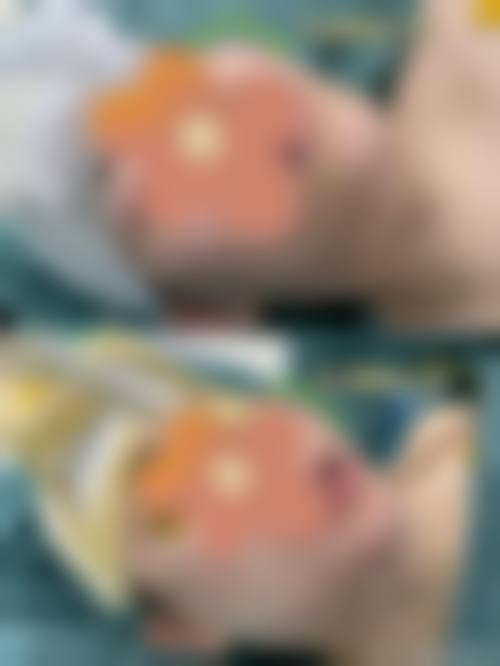 诸城市人民医院烧伤整形美容外科擅长项目
