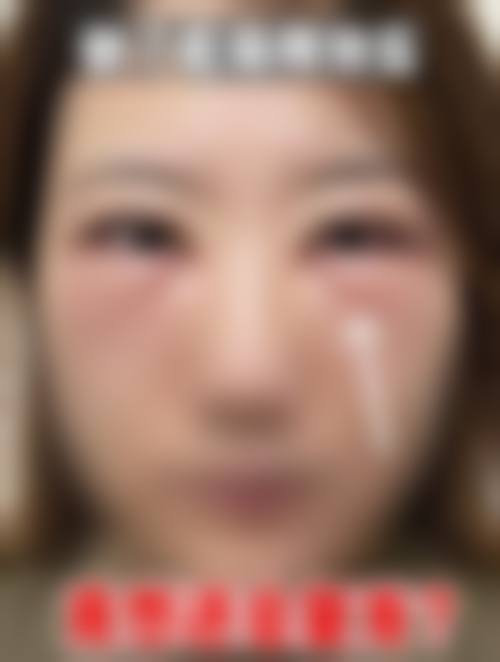 设备环境介绍:进口设备与层流手术环境