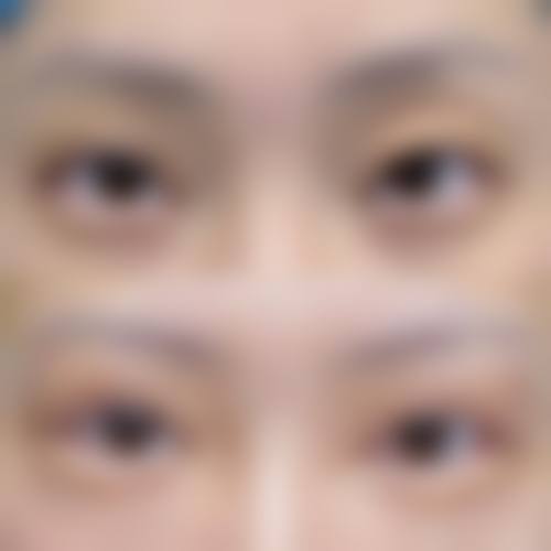 湘西明视眼科诊所预约挂号方式。