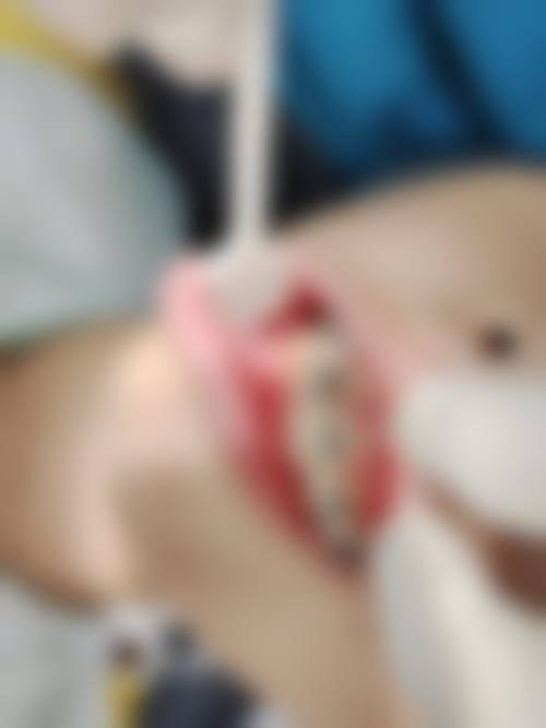 医院资质与实力:正规持证,无菌保护