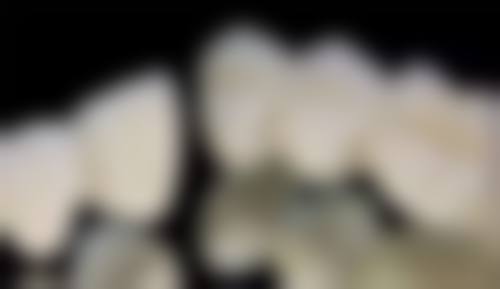 优惠活动详情:品质诊疗更亲民