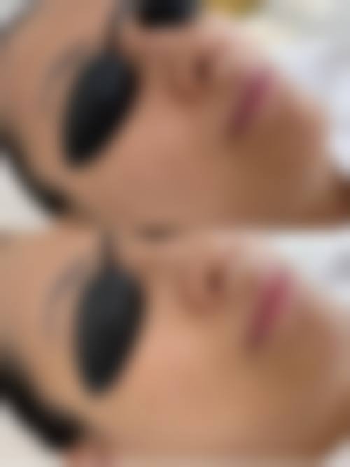 大理纯美医疗整形美容门诊部擅长项目。