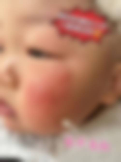 无锡市精神卫生中 心眼动检查眼科门诊营业时间。