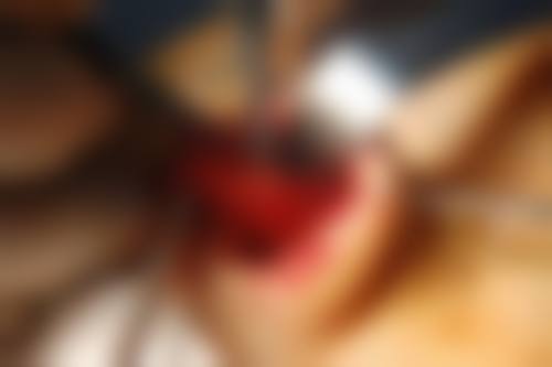 兰州市润妍医疗美容门诊部擅长项目。